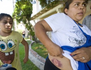 cw yesenia welts